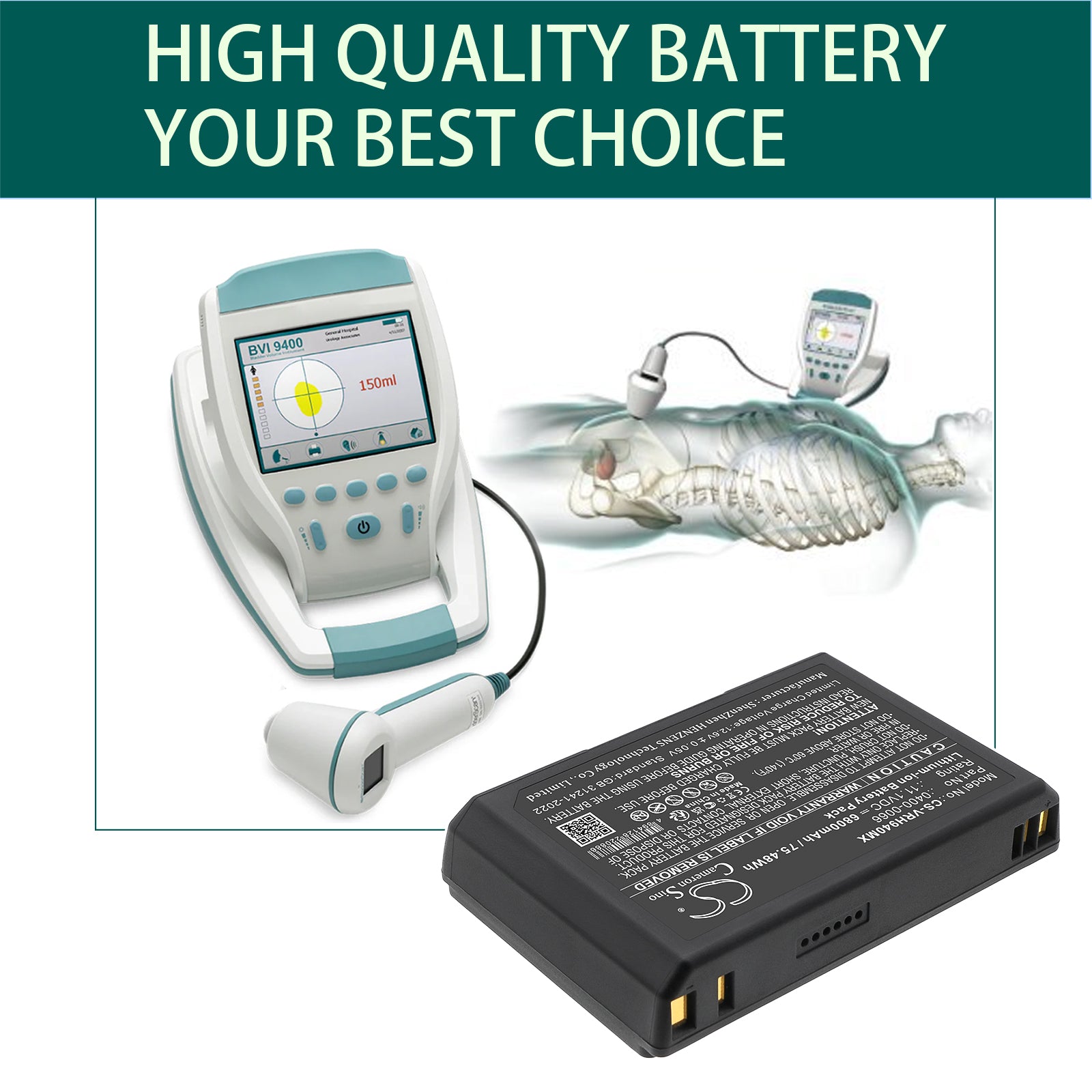 11.1V, Li-ion, 6800mAh, Battery fits Verathon 9400 Bladderscan, BVI 9400, 75.48Wh Medical Cameron Sino Technology Limited